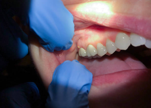 Best Teeth Whitening  in Morris, MN
